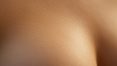 Breast Augmentation
