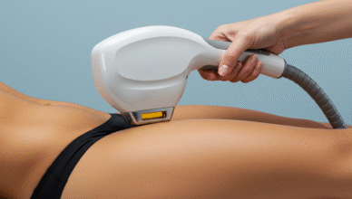 Laser Hair Removal