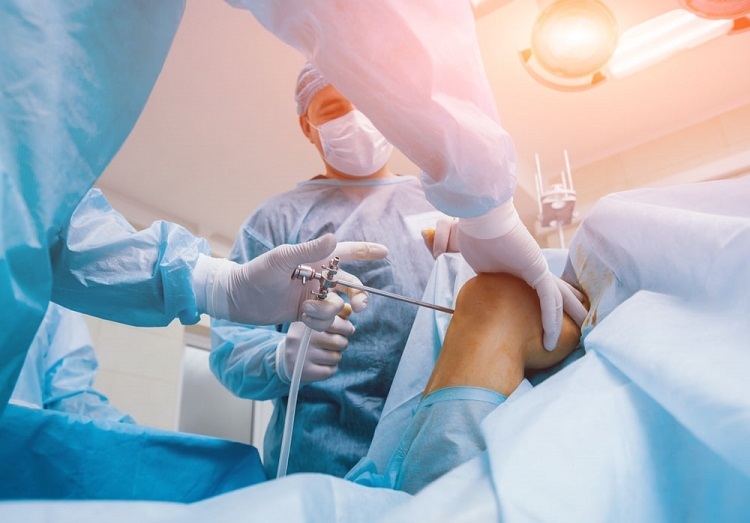Knee Arthroscopy