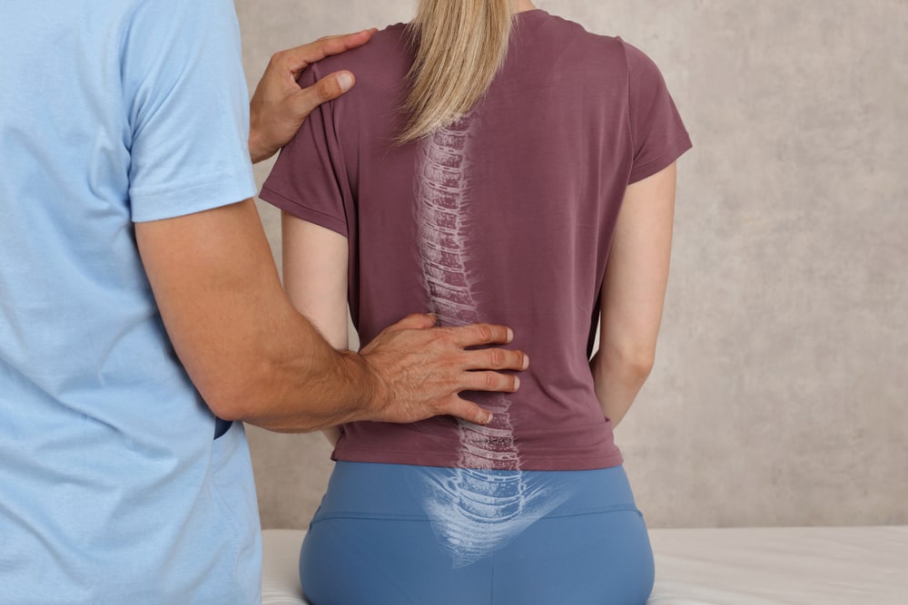 Scoliosis Treatments