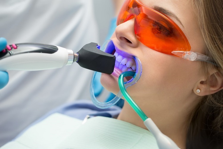 Improve Your Smile With Quality Teeth Whitening Dental Services in VA Teeth Whitening
