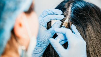 Hair Restoration Treatment