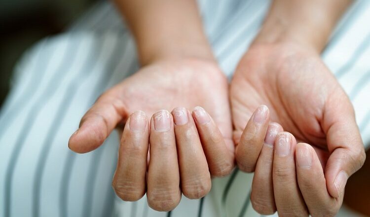 Access Professional Care for Your Nail Problems in New York Nail Problems