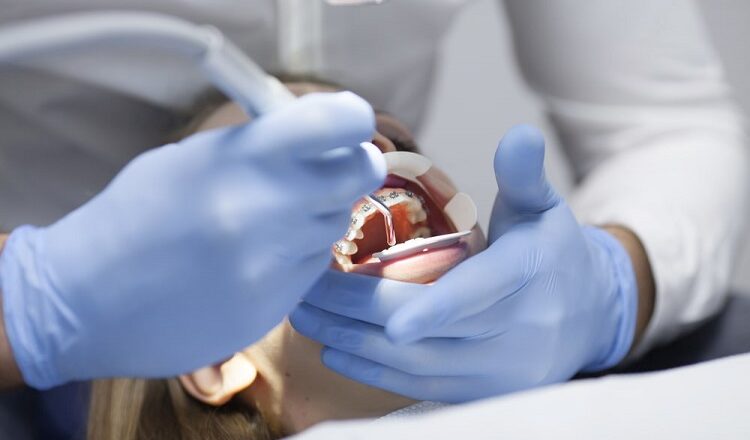 Understanding Surgical Orthodontics Surgical Orthodontics