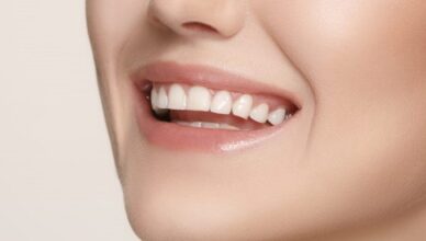 Whitening Gels