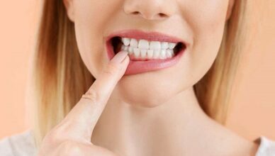 Loose Veneers