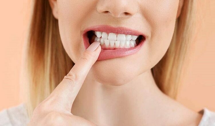 <strong><u>Loose Veneers: Causes and Treatments</u></strong> Loose Veneers
