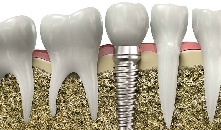 Do Not Worry about Your Extracted Tooth Extracted Tooth